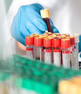 Blood Count Test