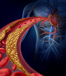Lipid Profile Test